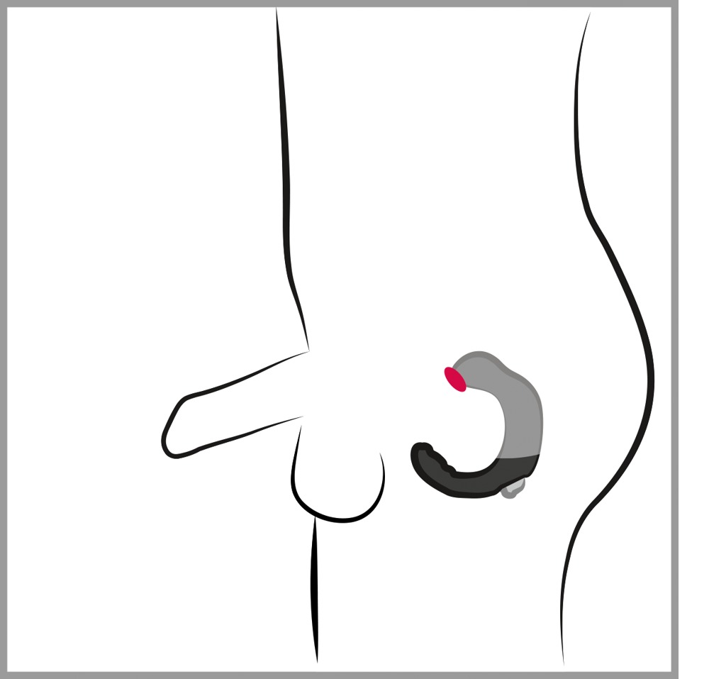 Prostate C-Form Noir - Miniature 5