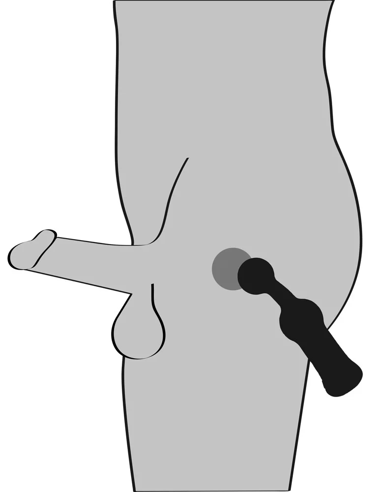 Stimulateur Prostatique Vibrant Prostate Vibrator - Miniature 5